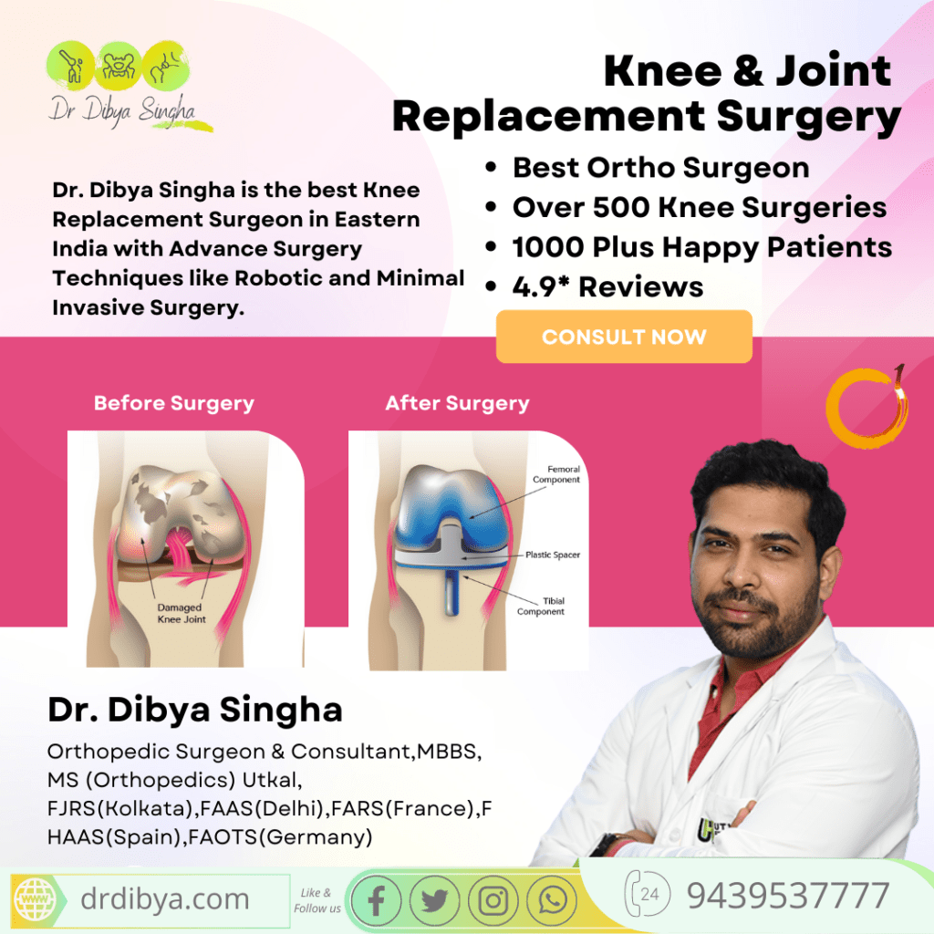 Latest and best Knee surgery procedures in 2022 by Dr Dibya Singha- Orthopedic consultant and surgeon
