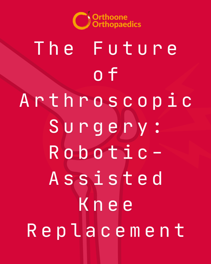 The Future of Arthroscopic Surgery Robotic-Assisted Knee Replacement